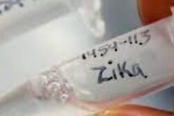 After Kanpur, Two Zika Virus Cases Found in UP's Lucknow