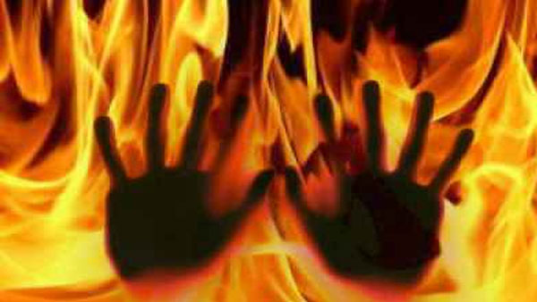 Woman burns daughter from second marriage to prove loyalty to third husband