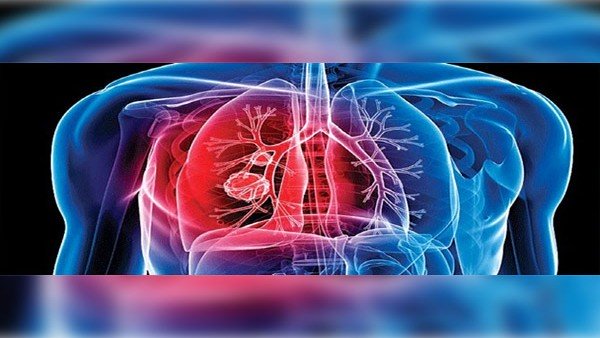 TB treatment duration to be reduced as ICMR initiates study