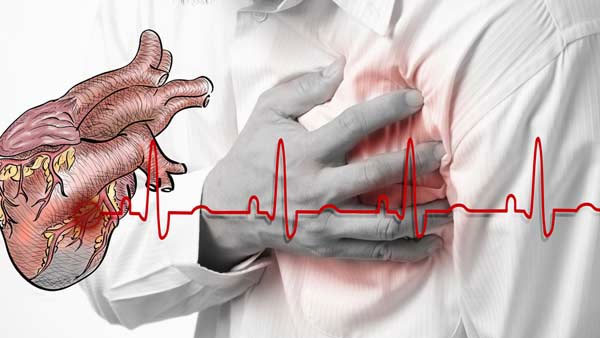 Cases of heart attacks at gym on the rise; Know the dos and don'ts of exercising