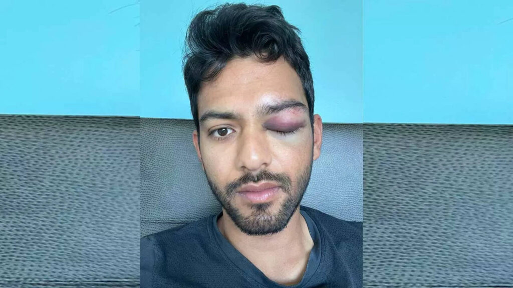 Former India U-19 star Unmukt Chand suffers serious eye injury