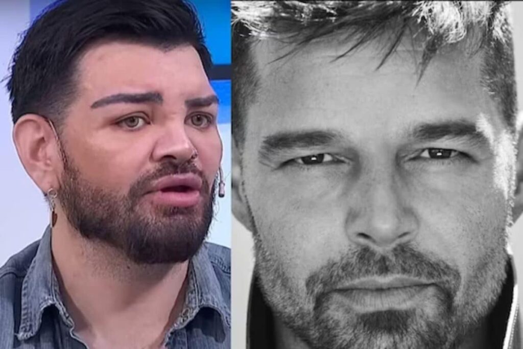 Argentina Man Spends Rs 6 Lakh On Surgeries To Look Like Singer Ricky Martin