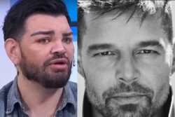 Argentina Man Spends Rs 6 Lakh On Surgeries To Look Like Singer Ricky Martin