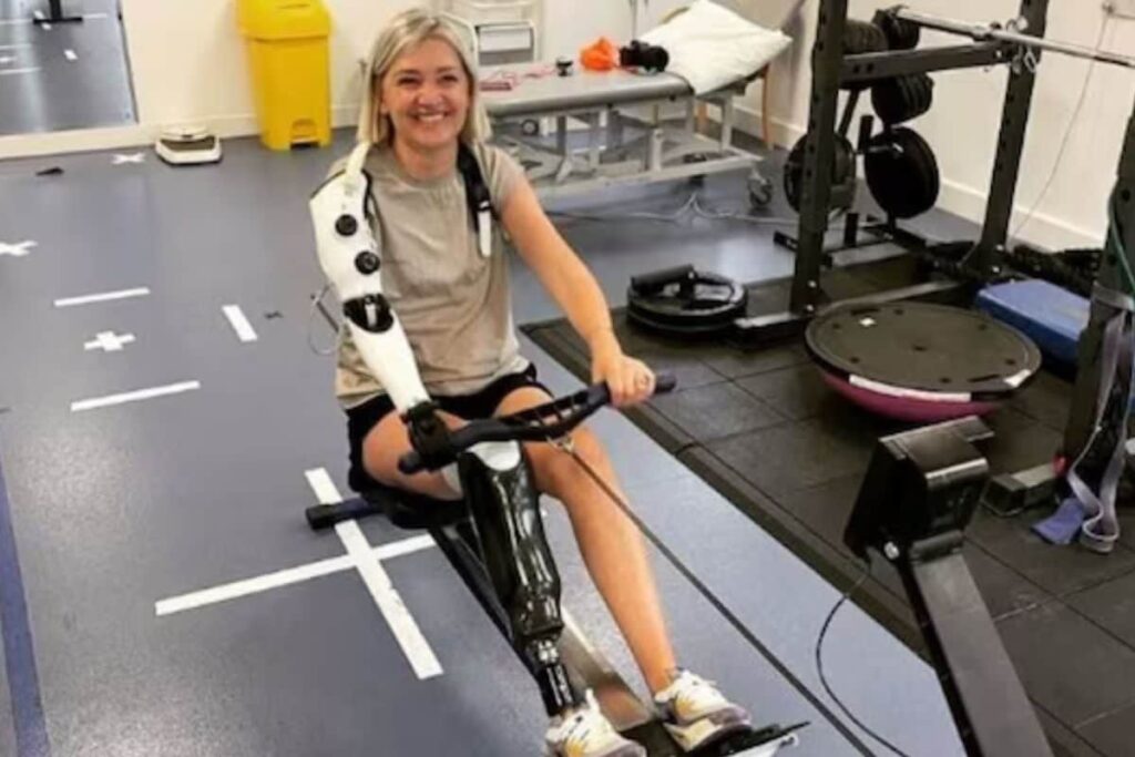 Meet Sarah de Lagarde, The First Person To Have An AI-controlled Bionic Arm