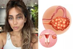 Anusha Dandekar Gets Surgery for Ovarian Lumps; Learn About the Condition, Causes and Symptoms