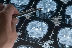 Kerala Teen Dies of Rare Brain Infection After Bathing in Contaminated Waters | Details Here