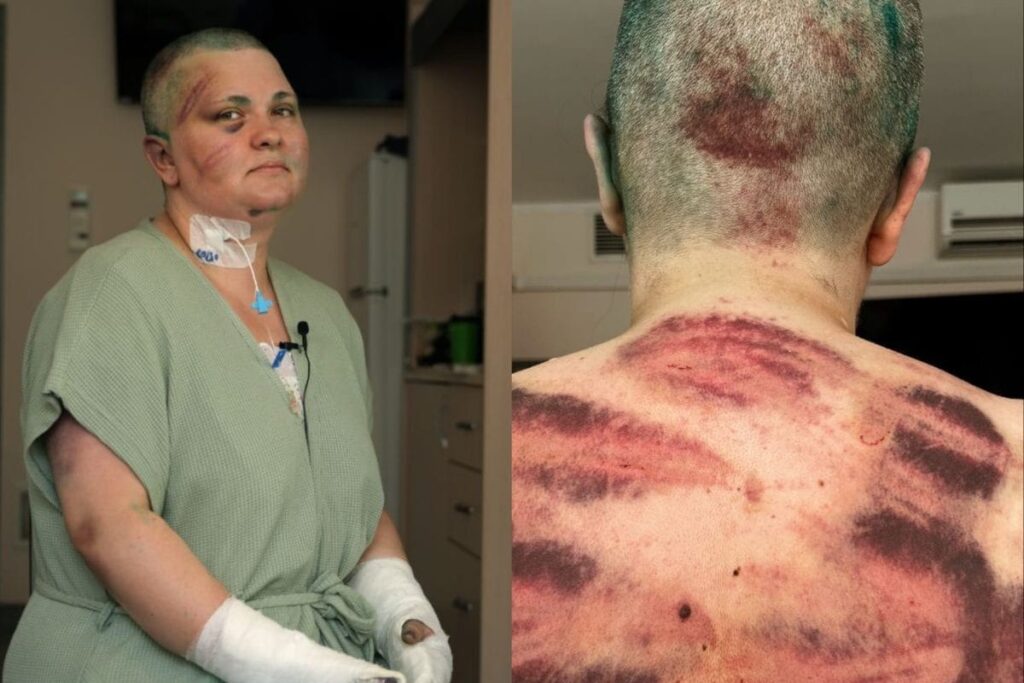Masked Men Beat Journalist, Shave Her Head, Pour Green Dye in Russia’s Chechnya; Probe Ordered