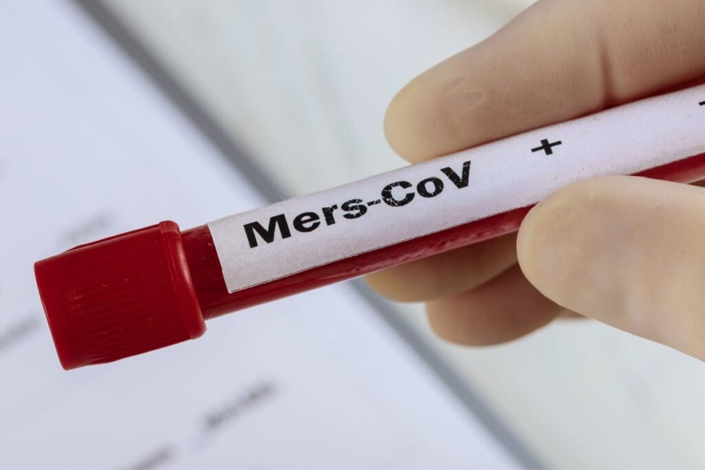 One Case of MERS Coronavirus Reported in Abu Dhabi City near Oman Border