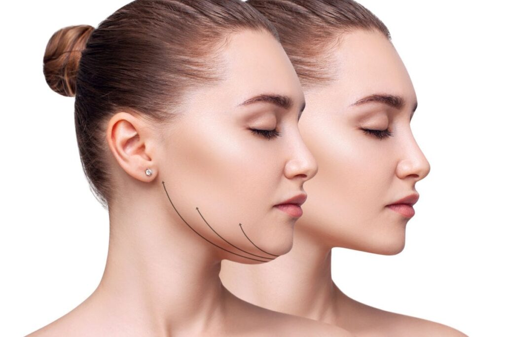 Double Chin Issues? Effective Exercises to Sculpt Your Jawline