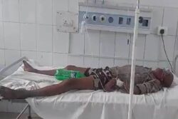 Bihar Shocker: Hospital Uses Sprite Bottle as Urine Bag Due to Critical Supply Shortage