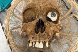 Horrifying Photo Of Human Skull Found In Donation Box In US