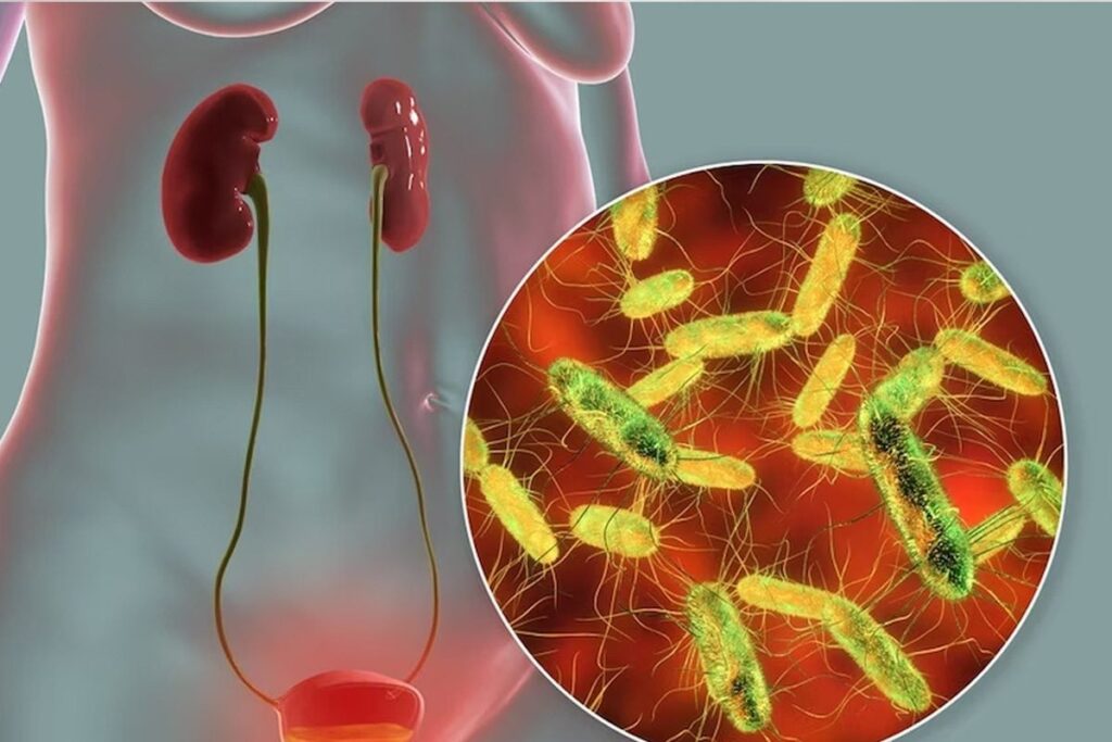 7 Healthy Habits To Take Care Of Your Urinary Bladder