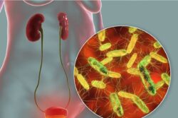 7 Healthy Habits To Take Care Of Your Urinary Bladder