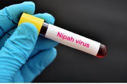 '...Not Nipah': Before Key Meet, Kerala Health Minister Says Samples of Two Patients Sent to NIV for Confirmation