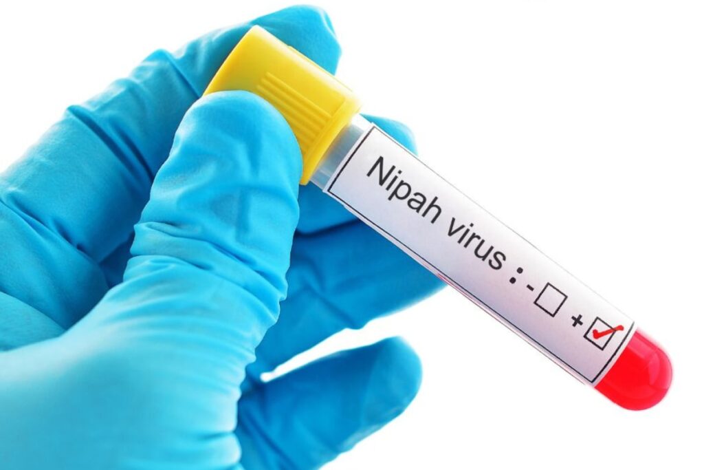 No New Positive Case of Nipah; 61 Negative Results: Kerala Govt