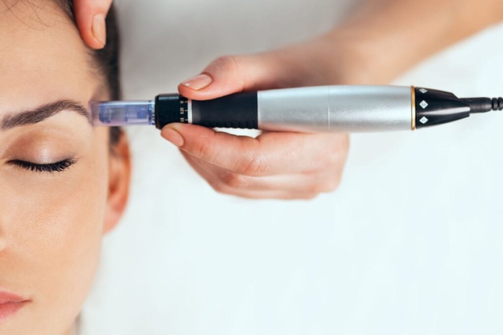 Mesotherapy for The Skin: All You Need To Know