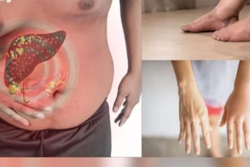 Swelling In Legs To Reduced Sexual Desire, Signs Of Fatty Liver Disease