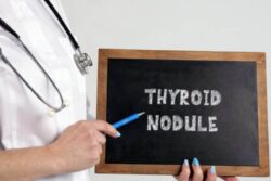 Understanding Thyroid Nodules: Are They Cancerous Or Not? Expert Chips In