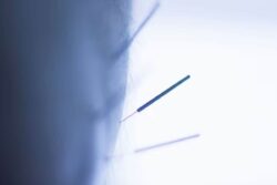 Doctors Save 2-Year-Old Peru Boy Who Swallowed 8 Needles