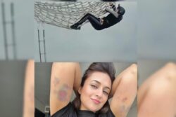 Khatron Ke Khiladi 13: Divyanka Tripathi's Bruises Show Her Undying Spirit