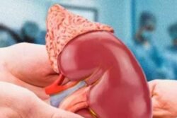 Expert Reveals How Organ Donations Save Lives And The Procedure For It