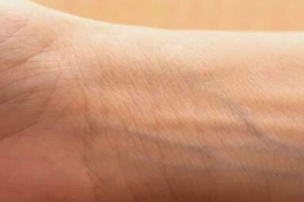 Why Our Veins Appear Blue Despite Carrying Red Blood