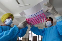 Covid Reinfection: 63% Indians Showed Symptoms, 22% Got it Multiple Times, Subsequent Cases More Severe in 20%