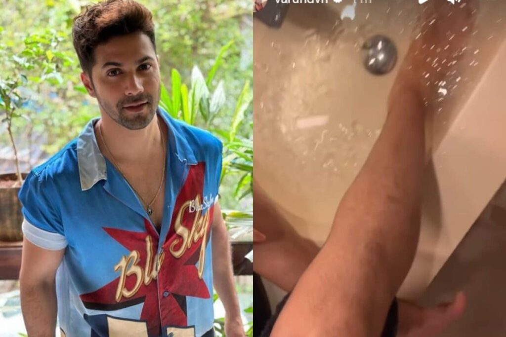 Varun Dhawan Injures His Leg During Atlee's VD18 Shoot, Shares Health Update; See Photo