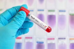 WHO Says No New Cases of Nipah Virus Detected in Kerala Since Sept 15