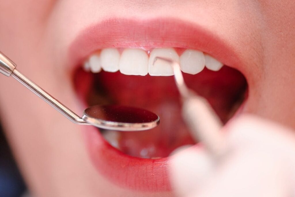 5 Reasons Why Getting Regular Dental Check-Ups Is Important
