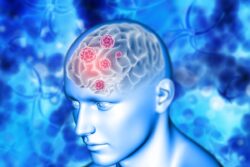 World Stroke Day 2023: Recognizing the Signs of Stroke: F.A.S.T.