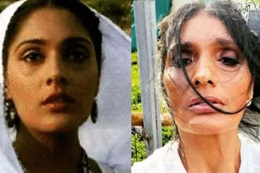 'Nobody Thought I Would Stand Up': Aashiqui Star Anu Aggarwal On Her Horrific Accident