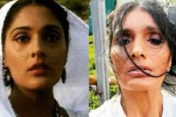 'Nobody Thought I Would Stand Up': Aashiqui Star Anu Aggarwal On Her Horrific Accident