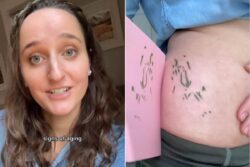Woman Turns Stretch Marks Into A Celebration Of Self-Acceptance And How