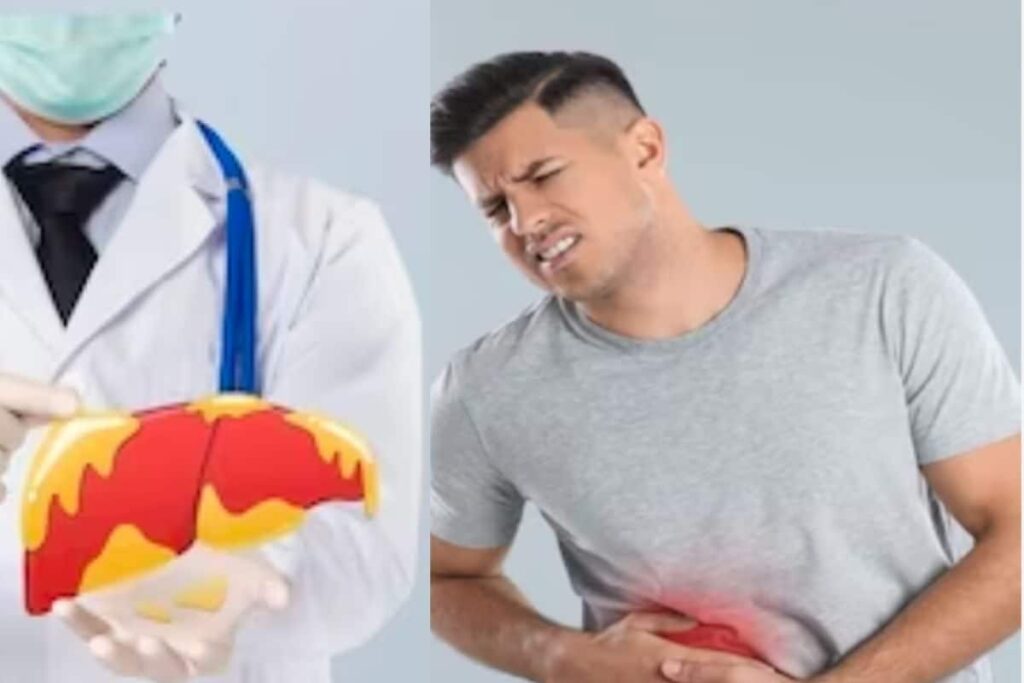 Non-alcoholic Fatty Liver Disease: 5 Warning Signs You Shouldn't Ignore