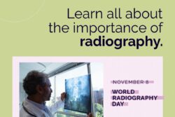 World Radiography Day 2023: History, Significance and Celebration