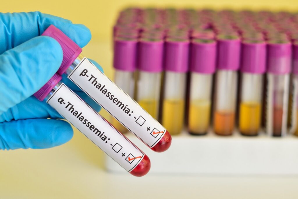 Thalassemia Patients at Risk, Critical Shortages Affecting Access to Blood Transfusions at Delhi Govt Hospitals