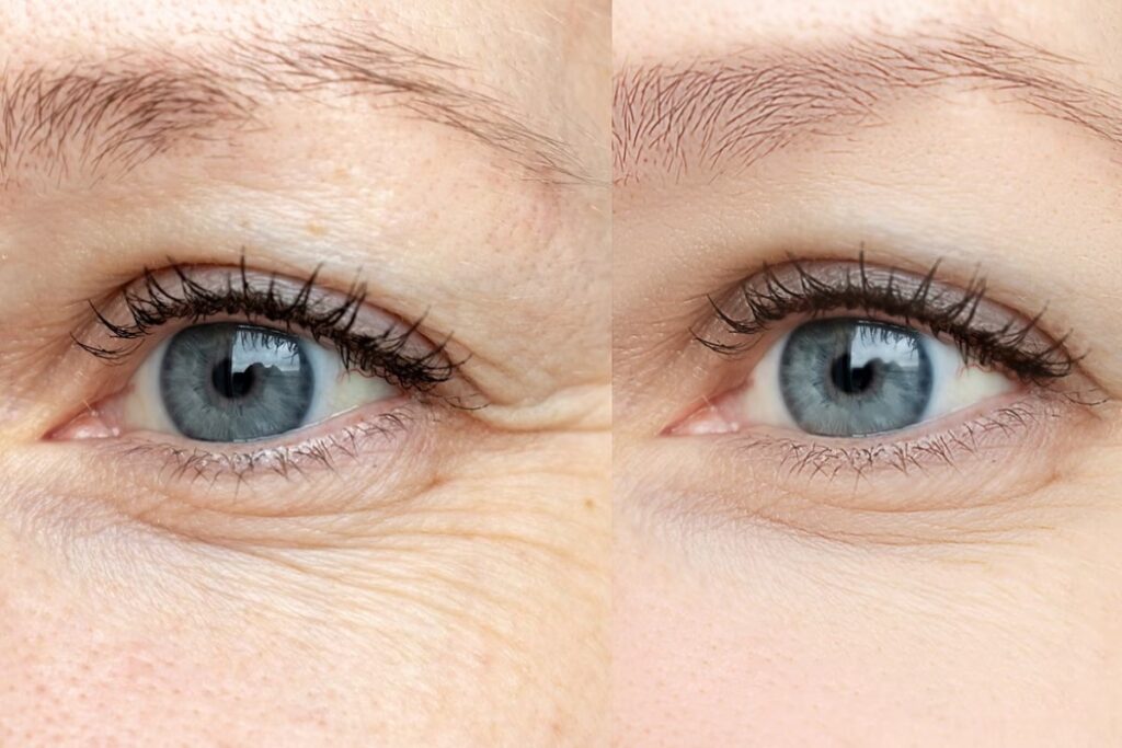 Can Hydrogen Therapy Reverse Ageing? Scientists Think So