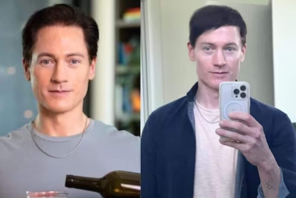 Ten Months Into De-ageing 'Project Baby Face', Tech Mogul Bryan Johnson Shares His Transformation Journey