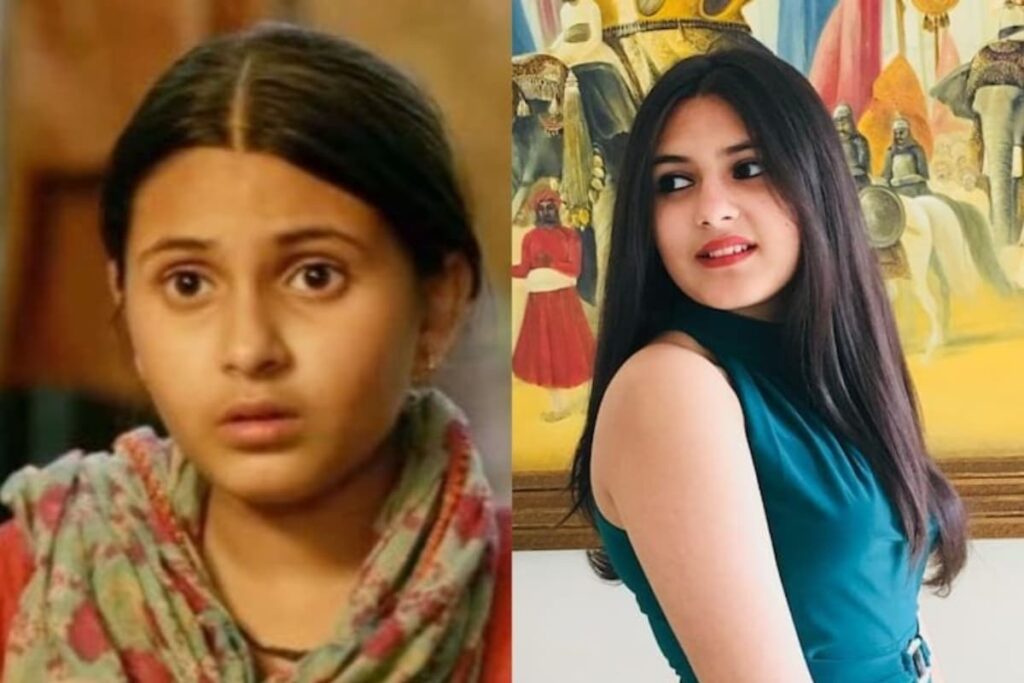 Purple Rashes, Fever & Muscle Weakness: What's Dermatomyositis, Rare Disease That Led to 'Dangal' Star's Death?