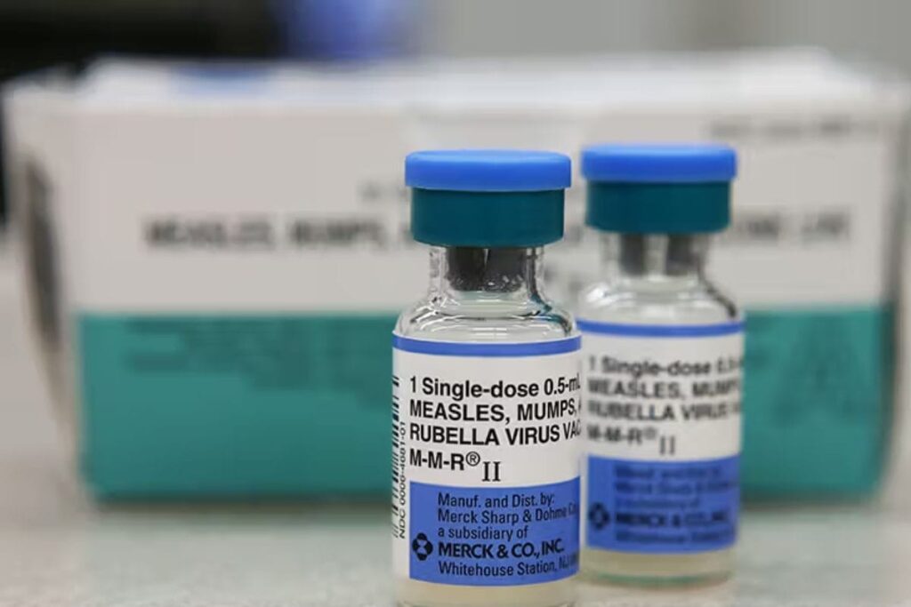 Kerala Sees Mumps Outbreak, Records 190 Cases In A Day | Check Symptoms, Advisories