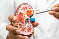 Why Kidney Stone Cases are Rising Among Gen Z and Millennials; Doctors Share Dos and Don’ts