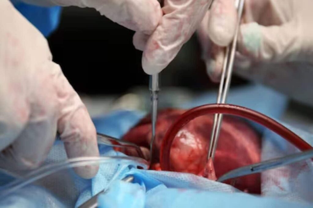 Kerala Doctor Operates On 4-Year-Old's Tongue Instead of Finger, Suspended After Outrage