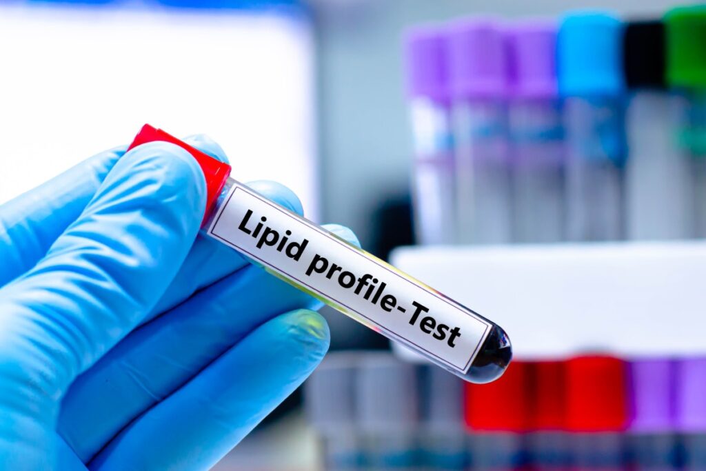 Gift Yourself a Lipid Profile Test Every Birthday or Anniversary and Learn to Read the Results | Health Matters