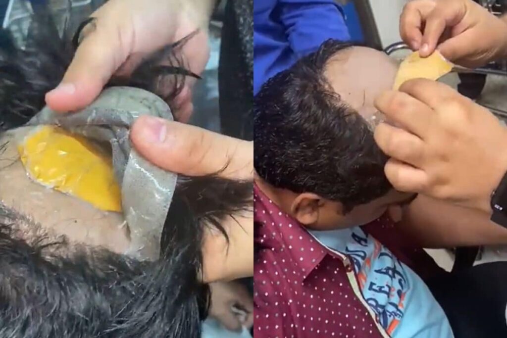 Man Conceals Gold Worth Rs 30 Lakh in Fake Hair, Rectum; Nabbed at Delhi Airport | WATCH VIDEO