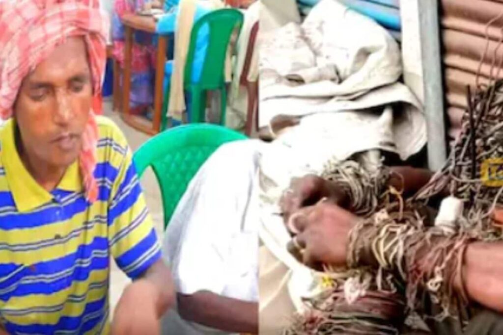In West Bengal's North 24 Parganas, Locals Rescue 'Iron Man' After Years Of Struggle