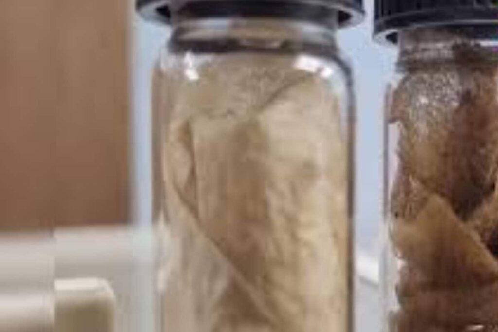 In Bengal, Raiganj University Devises Bandages Made From Silk Cocoon