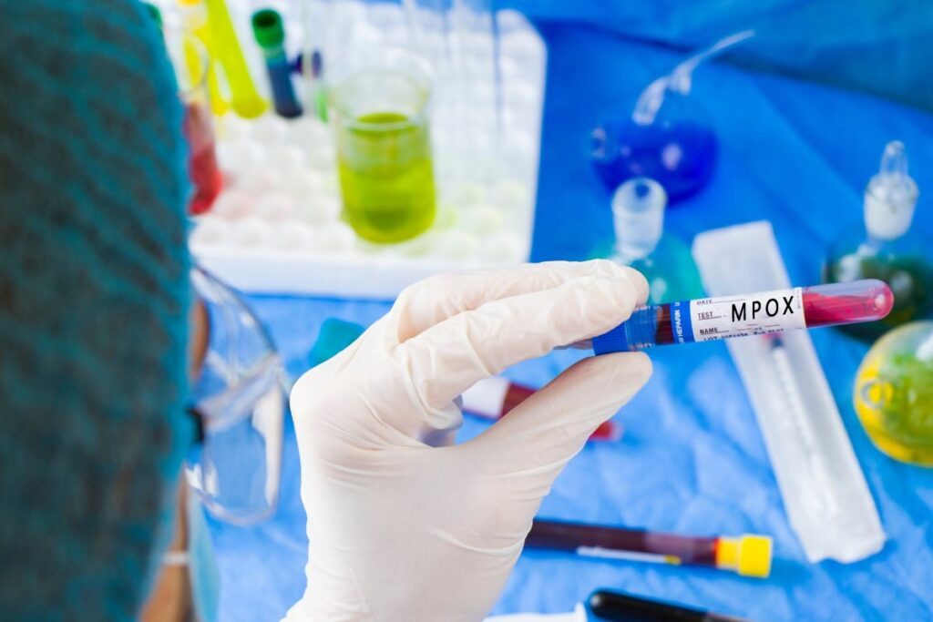 Mpox May Not be as Deadly as Covid-19, But Complacency Not An Option: Experts to News18