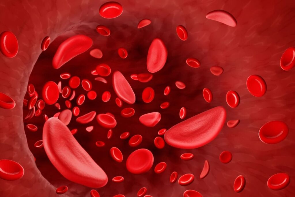 Chhattisgarh, MP & Maharashtra Lead Sickle Cell Anaemia Screening, Bihar Lags Behind: Govt Data