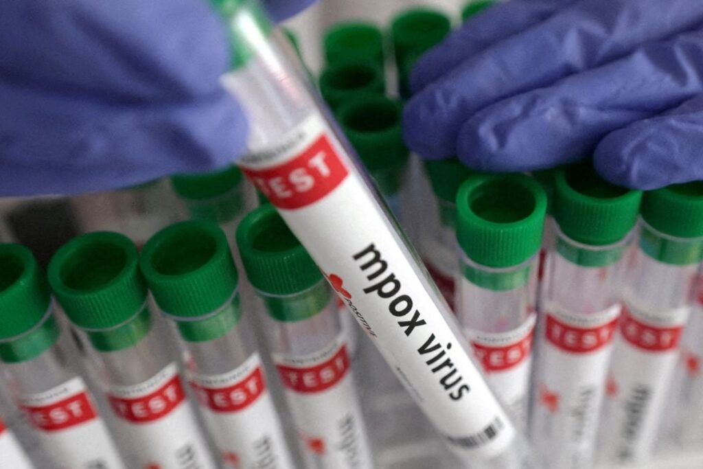 Local Clinic To Dermatology OPD: How Mpox Was Confirmed In Kerala’s 38-Year-Old Patient